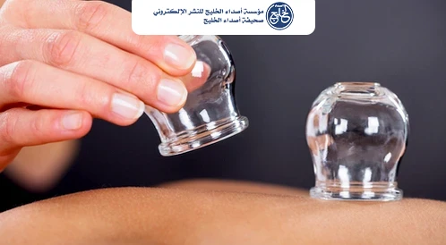 "الطب البديل": زيادة دم الحجامة لا تعني فاعلية أعلى