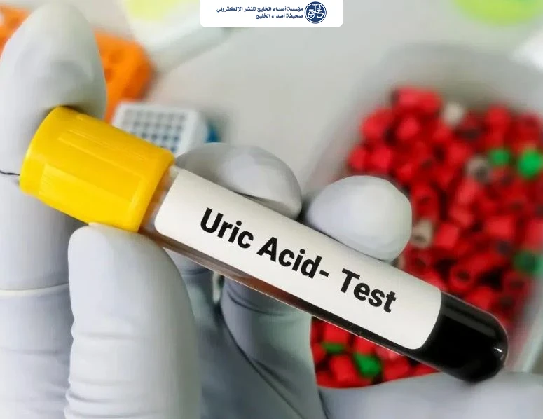 دراسة: النقرس يتوسع بين الشباب ومخاطر صحية محتملة